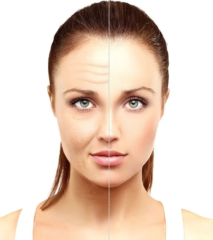Client skin transformation result at a beauty salon in Indore — 5